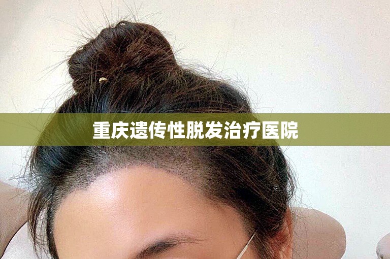 南京有名的植发医生选择方案