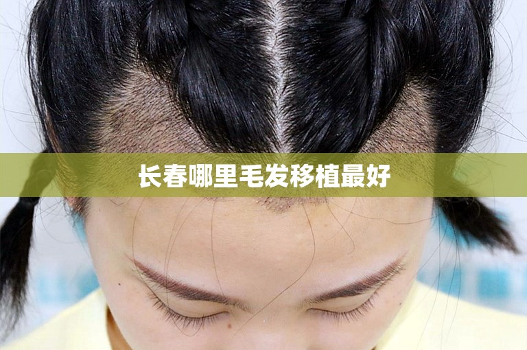 北京最权威的植发门诊选择方案