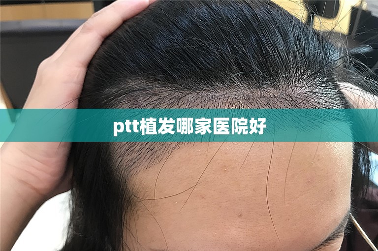 惠州知名的植发门诊怎么选