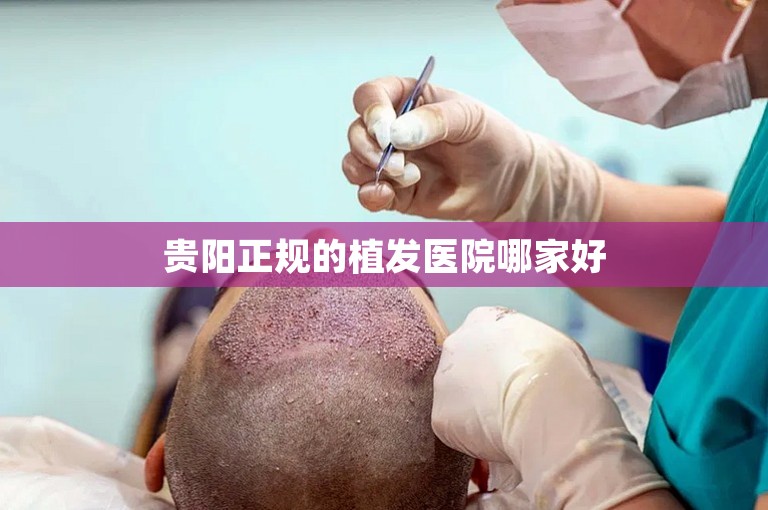 上海植发医院哪个效果好？
