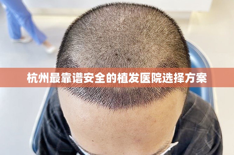 杭州最靠谱安全的植发医院选择方案