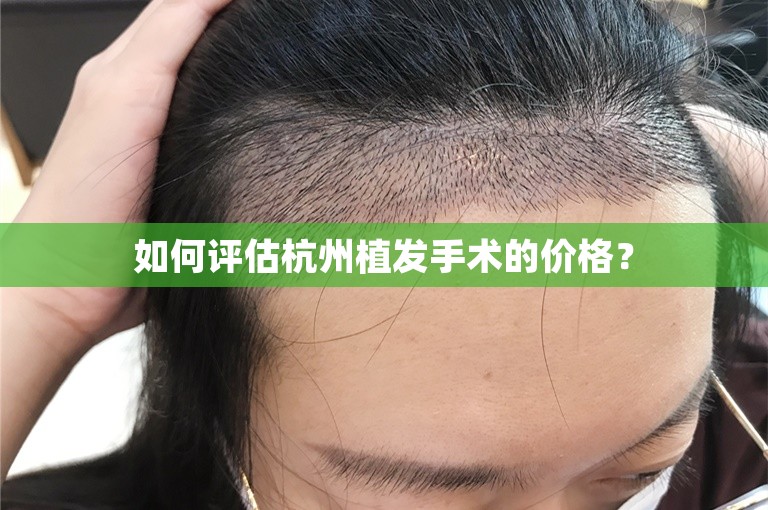 如何评估杭州植发手术的价格？