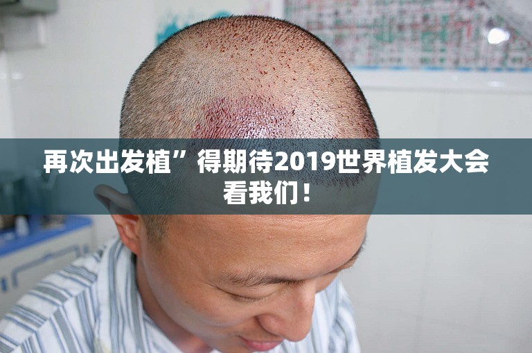 上海医院种植毛发多少钱