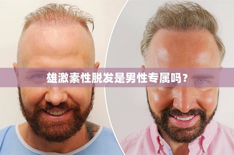 广州种植头发费用多少钱