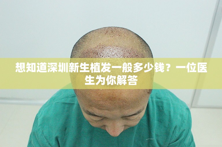想知道深圳新生植发一般多少钱？一位医生为你解答
