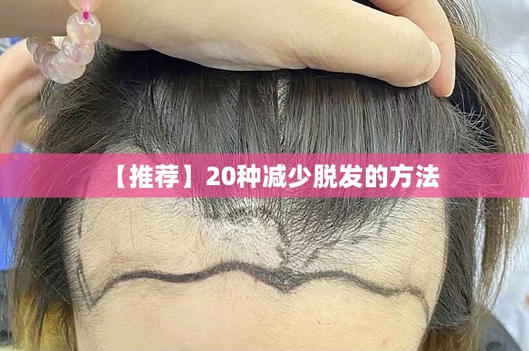 【推荐】20种减少脱发的方法