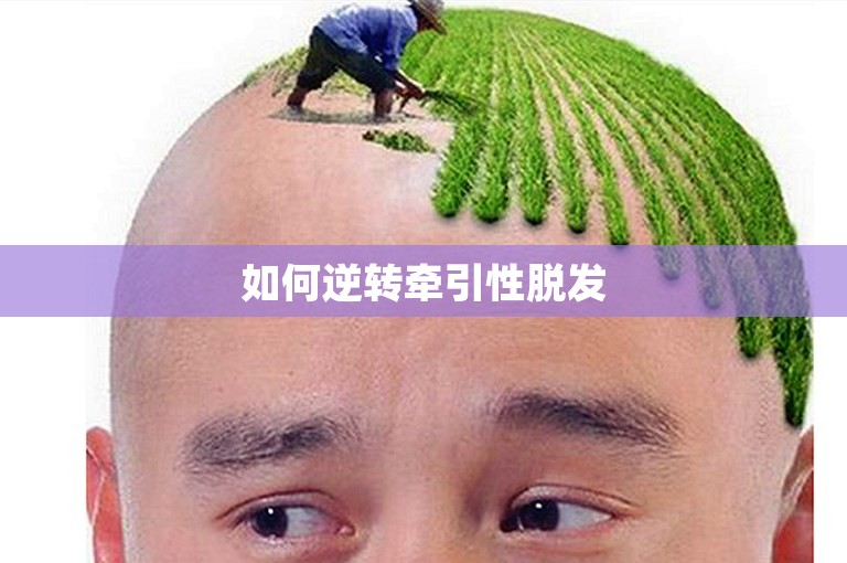 如何逆转牵引性脱发