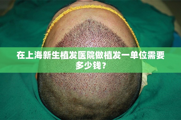 在上海新生植发医院做植发一单位需要多少钱？