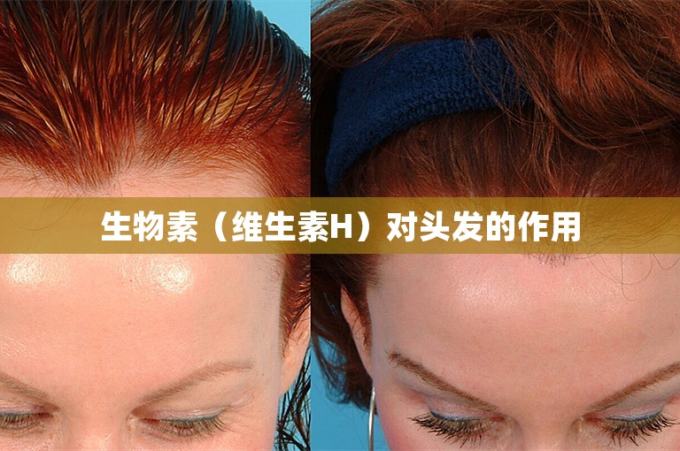 生物素（维生素H）对头发的作用