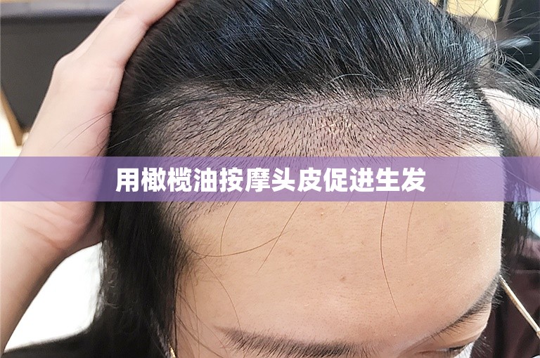 在广州种植头发多少钱