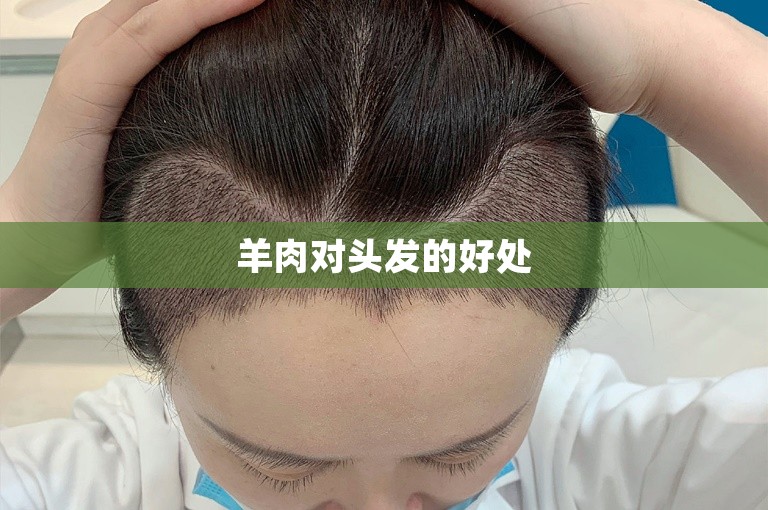 在广州碧莲盛植发需要多少钱
