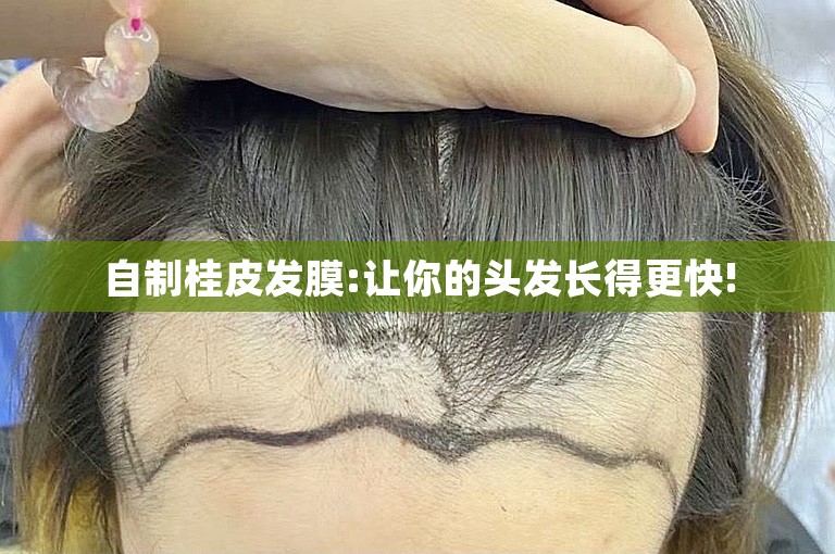 自制桂皮发膜:让你的头发长得更快!