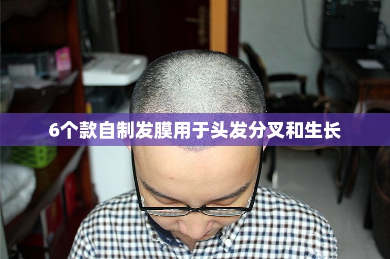 6个款自制发膜用于头发分叉和生长