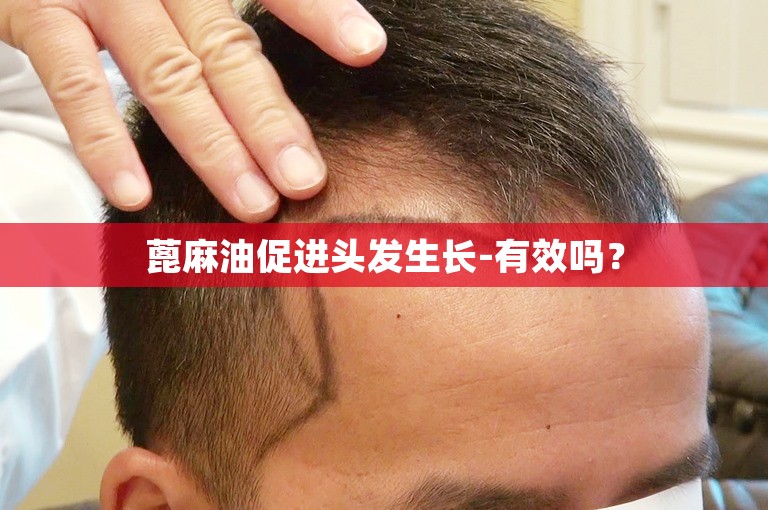 想要拥有浓密秀发？从医生的角度来看，台州植发多少钱一个单位？