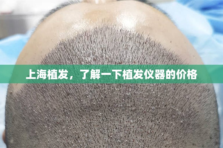 上海植发，了解一下植发仪器的价格