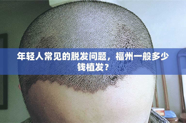 年轻人常见的脱发问题，福州一般多少钱植发？