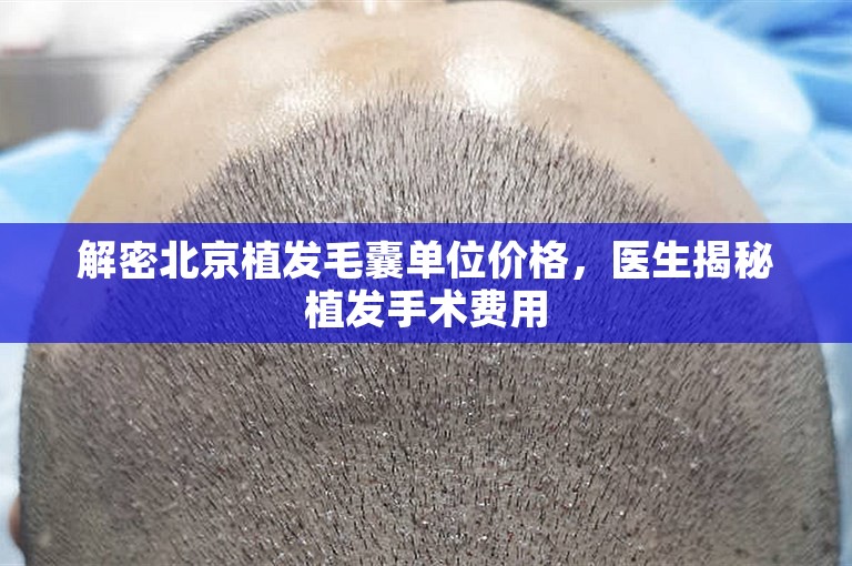 解密北京植发毛囊单位价格，医生揭秘植发手术费用