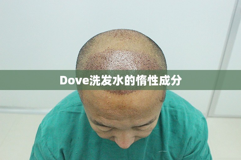 Dove洗发水的惰性成分