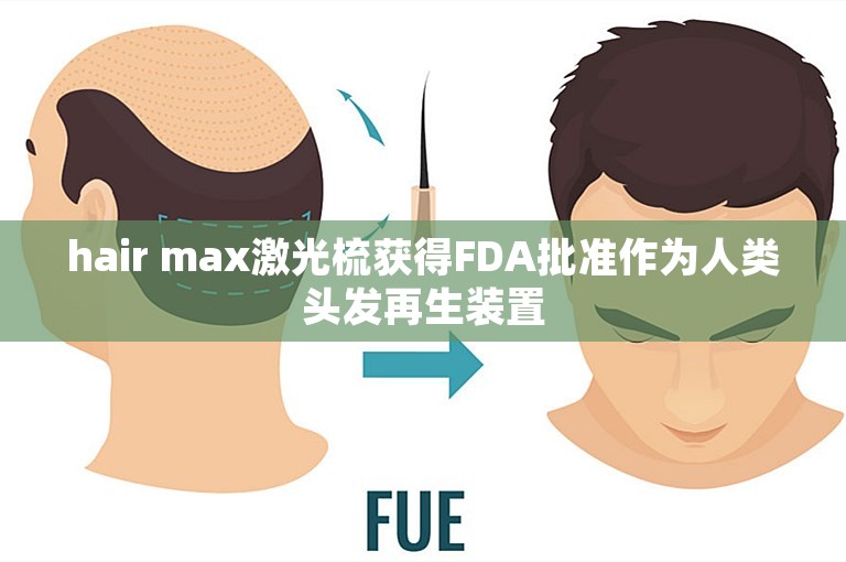hair max激光梳获得FDA批准作为人类头发再生装置