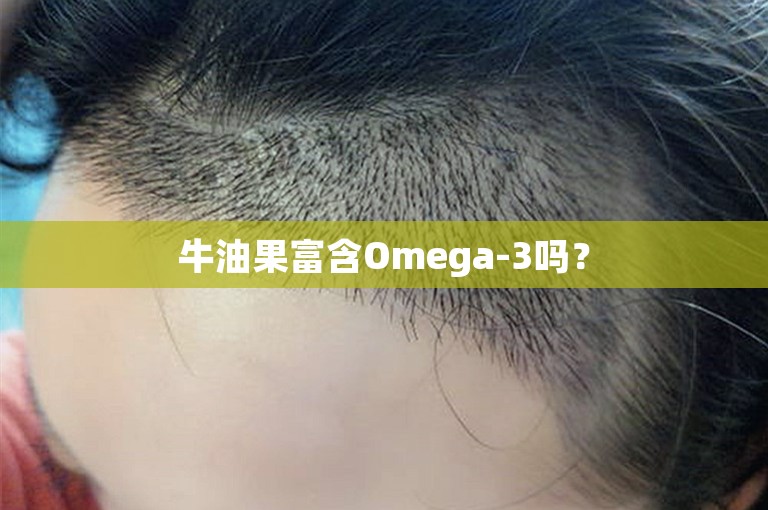 牛油果富含Omega-3吗？