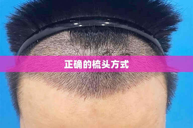 扎实地解决脱发难题——我在武汉5000个毛囊植发的经历