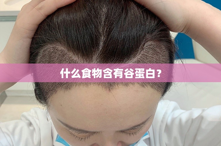 植发观察：上海植发的效果好吗？多少钱？