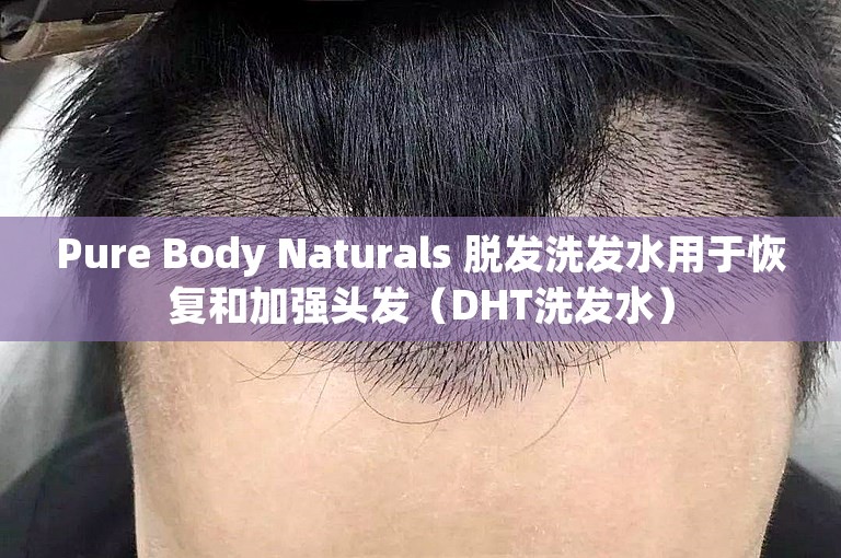 Pure Body Naturals 脱发洗发水用于恢复和加强头发（DHT洗发水）