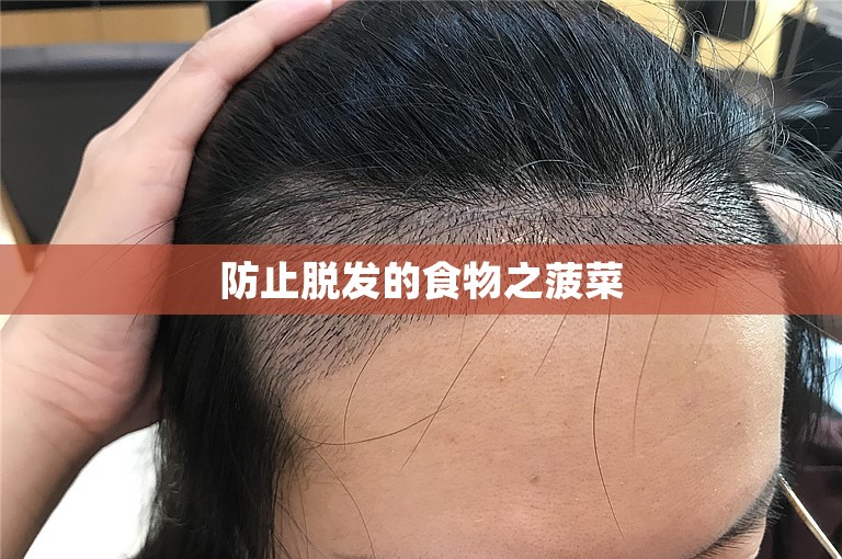 郑州1000个毛囊单位植发，医院怎么收费？