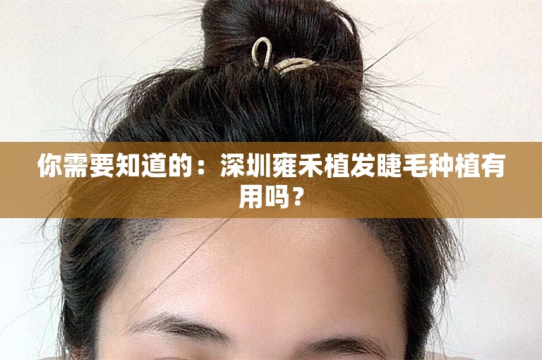 你需要知道的：深圳雍禾植发睫毛种植有用吗？