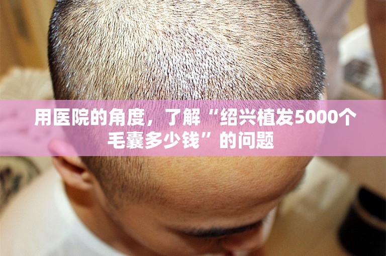  用医院的角度，了解“绍兴植发5000个毛囊多少钱”的问题 