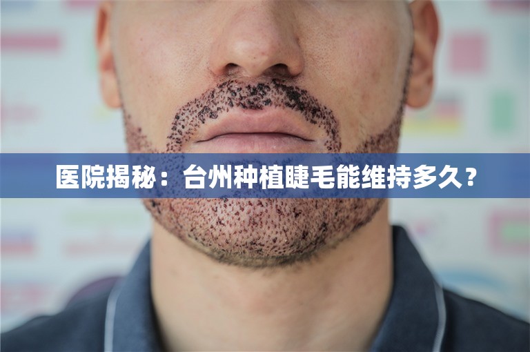 医院揭秘：台州种植睫毛能维持多久？