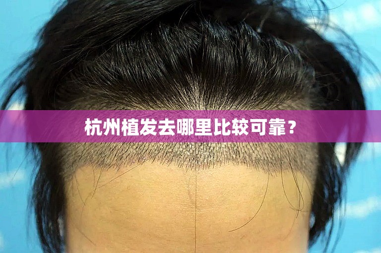 杭州植发去哪里比较可靠？