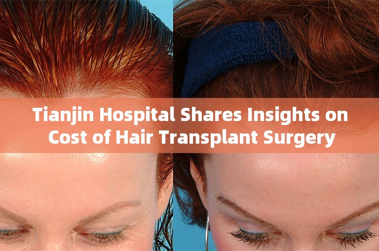 Tianjin Hospital Shares Insights on Cost of Hair Transplant Surgery