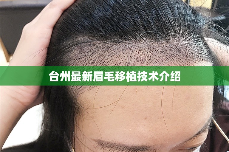 台州最新眉毛移植技术介绍