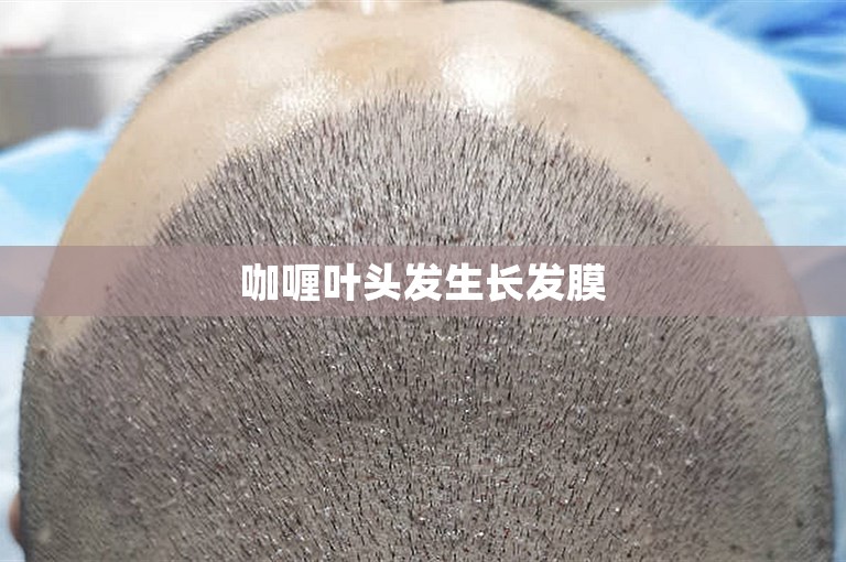 惠州植发手术多少钱？