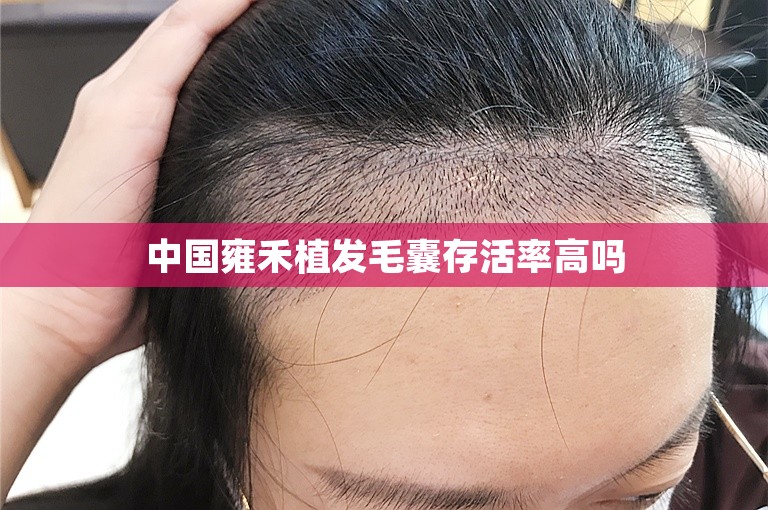 中国雍禾植发毛囊存活率高吗