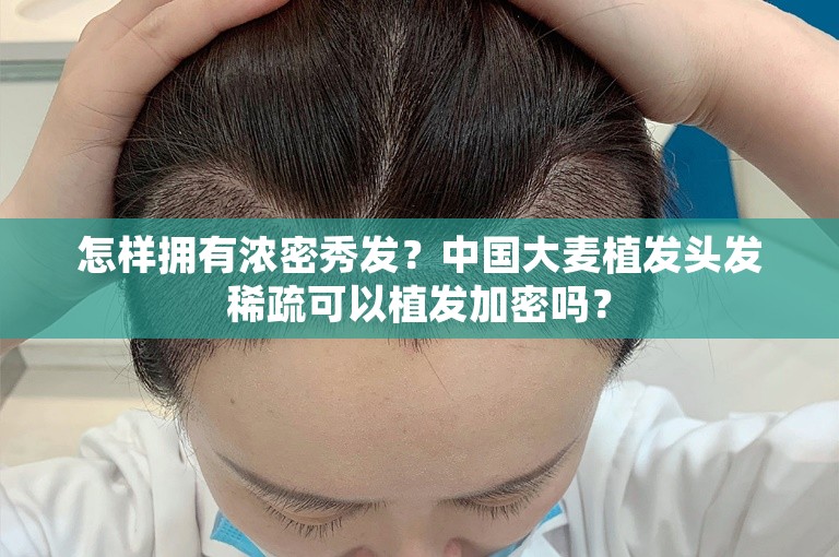 怎样拥有浓密秀发？中国大麦植发头发稀疏可以植发加密吗？