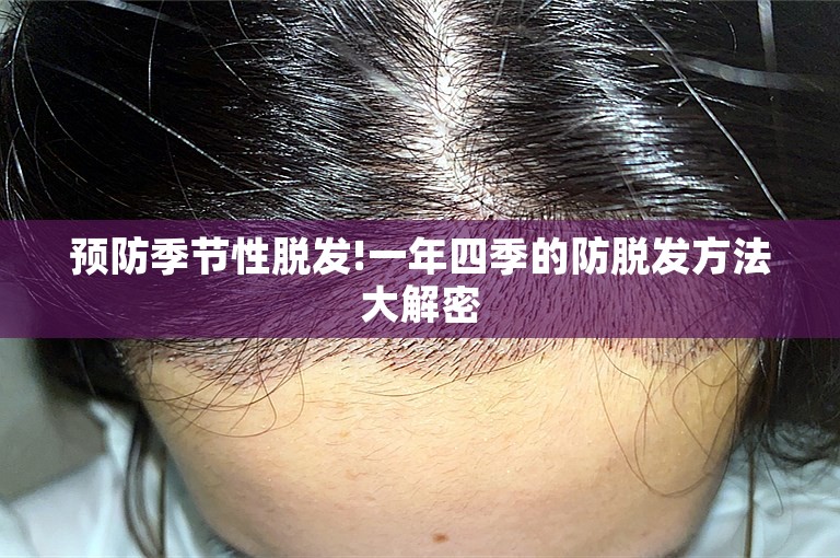 预防季节性脱发!一年四季的防脱发方法大解密