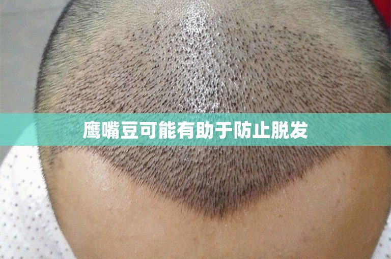 鹰嘴豆可能有助于防止脱发