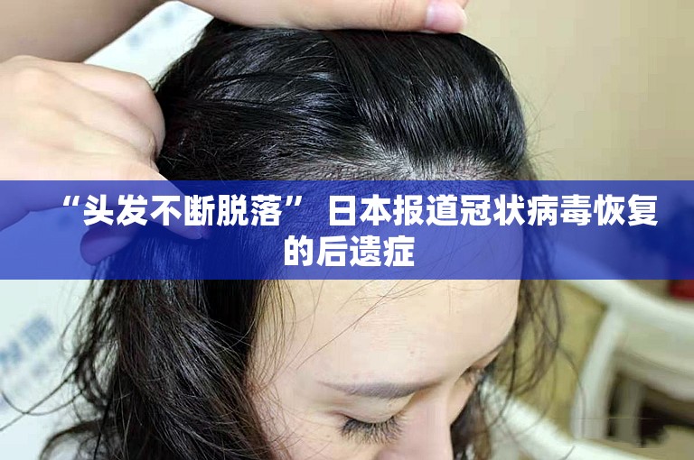 “头发不断脱落” 日本报道冠状病毒恢复的后遗症
