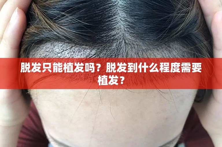 红外线治疗能在多大程度上改善脱发？