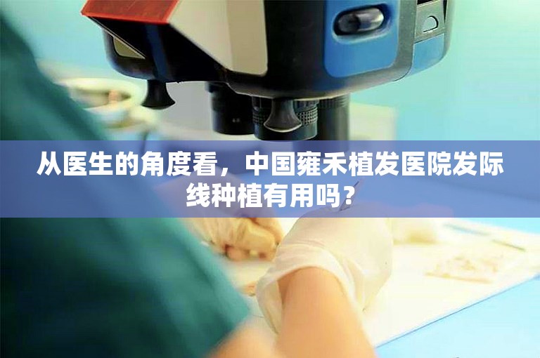 从医生的角度看，中国雍禾植发医院发际线种植有用吗？