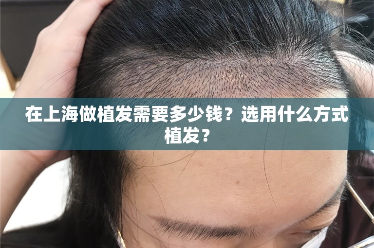 在上海做植发需要多少钱？选用什么方式植发？