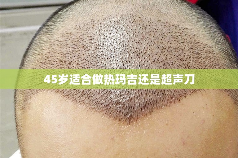 45岁适合做热玛吉还是超声刀