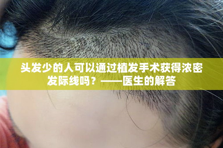 头发少的人可以通过植发手术获得浓密发际线吗？——医生的解答
