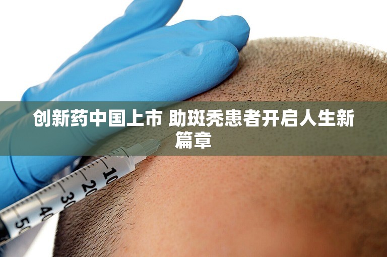 创新药中国上市 助斑秃患者开启人生新篇章
