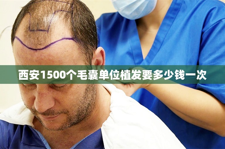 西安1500个毛囊单位植发要多少钱一次