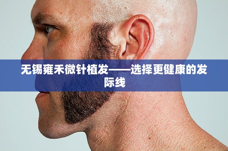 无锡雍禾微针植发——选择更健康的发际线