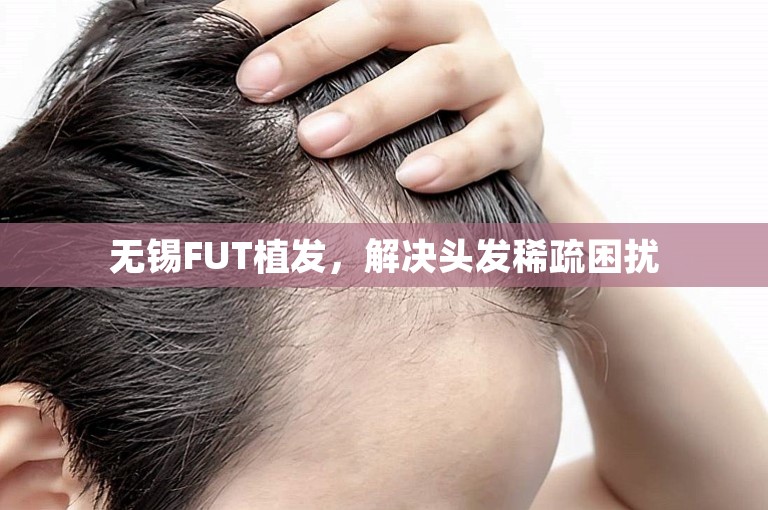 无锡FUT植发，解决头发稀疏困扰