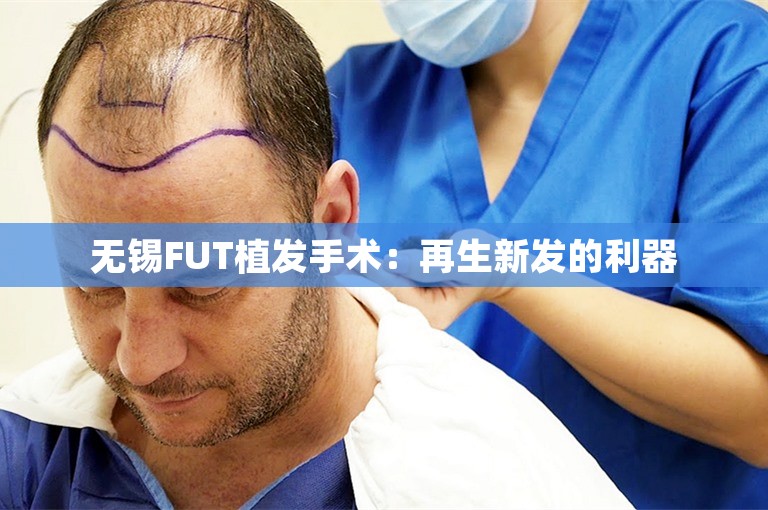 无锡FUT植发手术：再生新发的利器